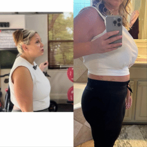 san antonio weight loss, texas weight loss